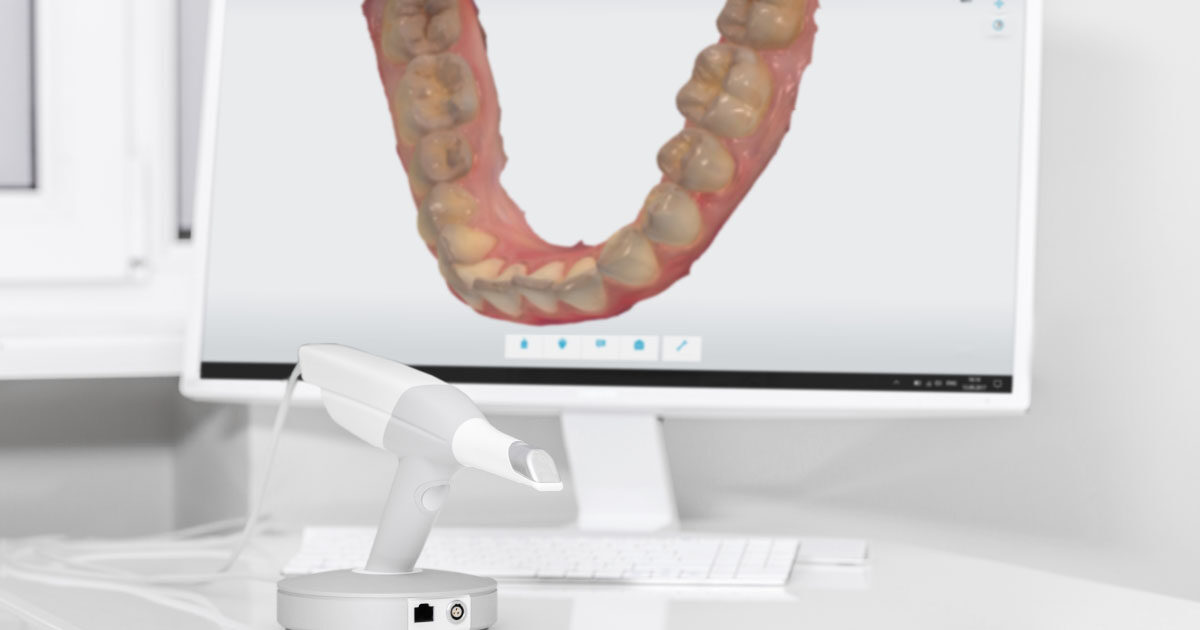 odontoiatria-digitale-SMILE-1200x630.jpg